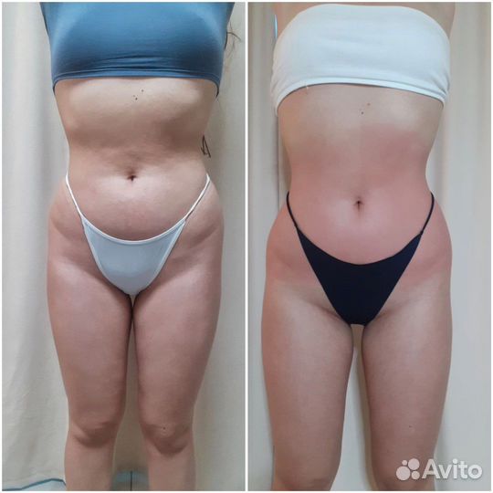 Антицеллюлитный Массаж