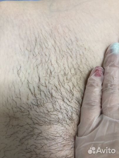 Шугаринг быстро и без боли