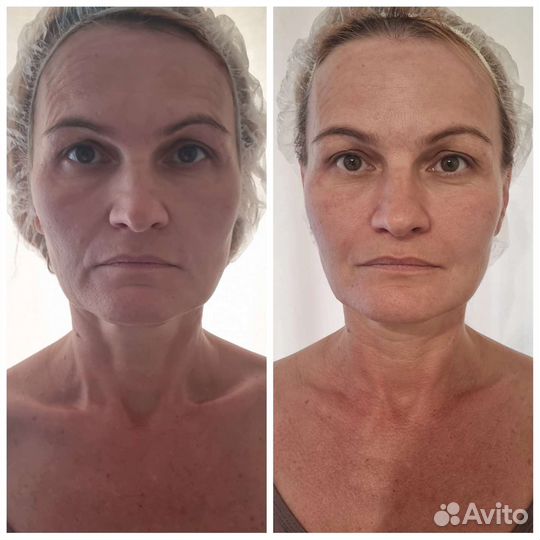 Массаж на дому