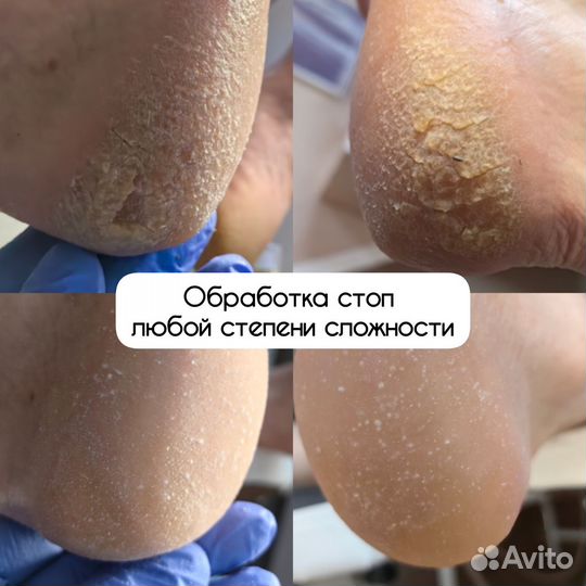 Педикюр с выездом на дом