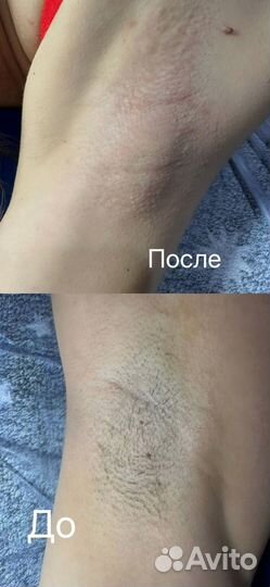 Наращивание ресниц, шугаринг