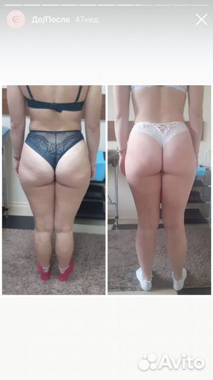 Массаж антицеллюлитный/lpg/кавитация/RF лифтинг