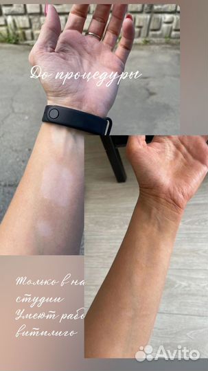 Моментальный загар