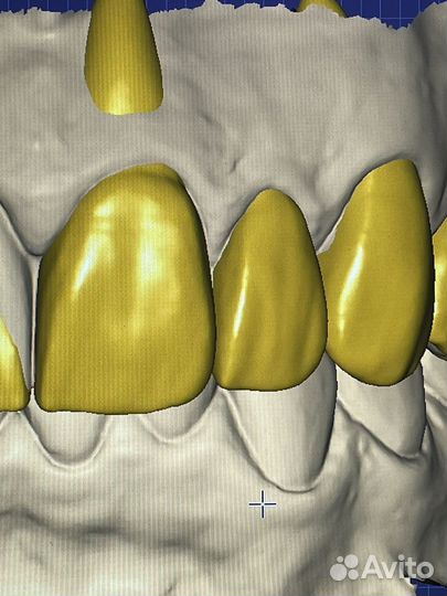 3d моделирование exocad
