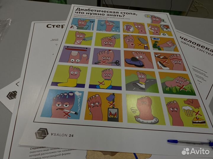 Плакат диабетическая стопа