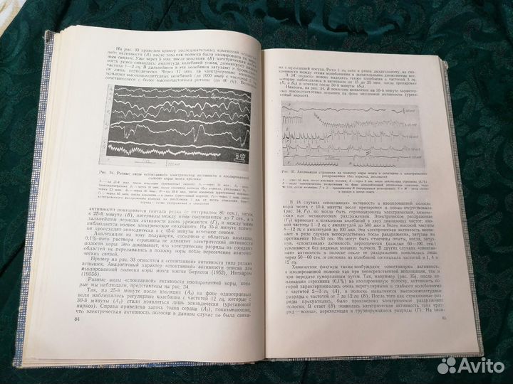 Медленные электрические процессы в головном мозге