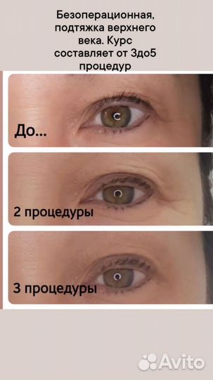 Услуги косметолога