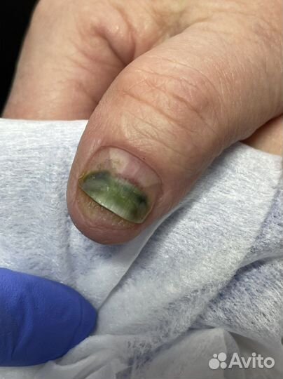 Выезд на дом, подолог