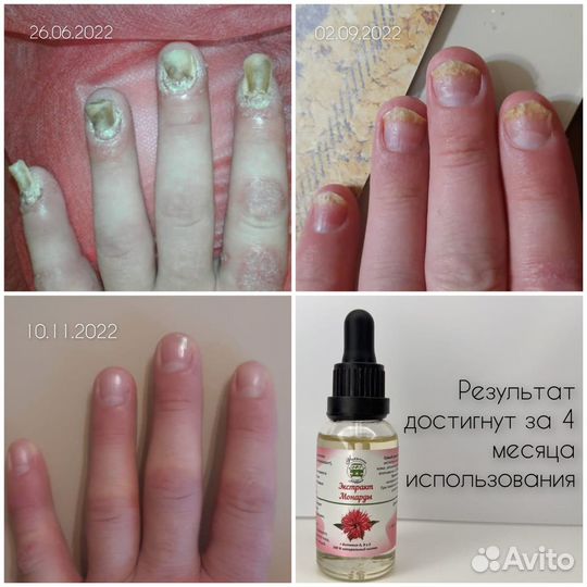 Подолог,медицинский педикюр,педикюр пожилым. Выезд