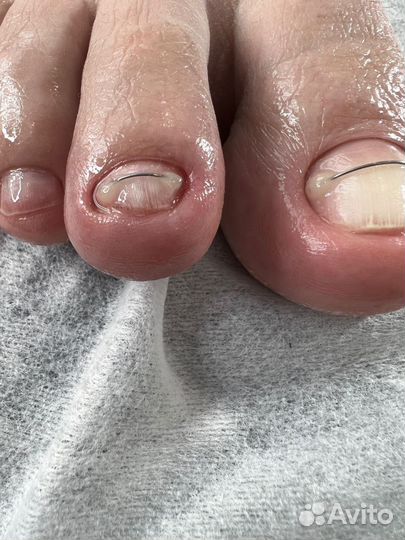 Педикюр на дому