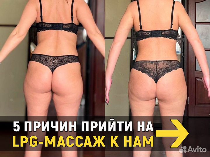 LPG массаж. Оригинальный аппарат