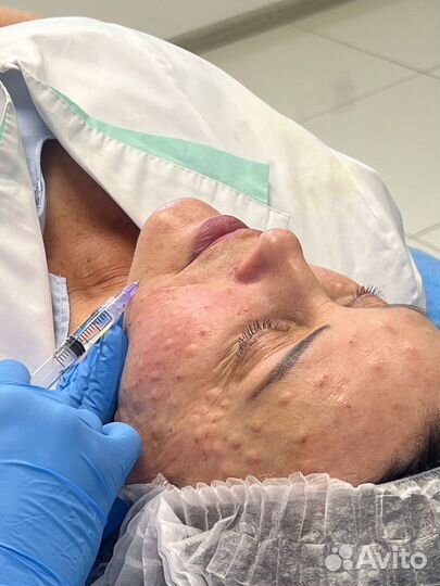 Биopeвитaлизaция