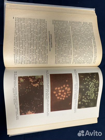 Патологическая физиология, анатомия. Адо, Струков