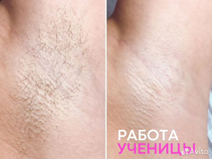 Обучение онлайн, Курсы Воск, Шугаринг