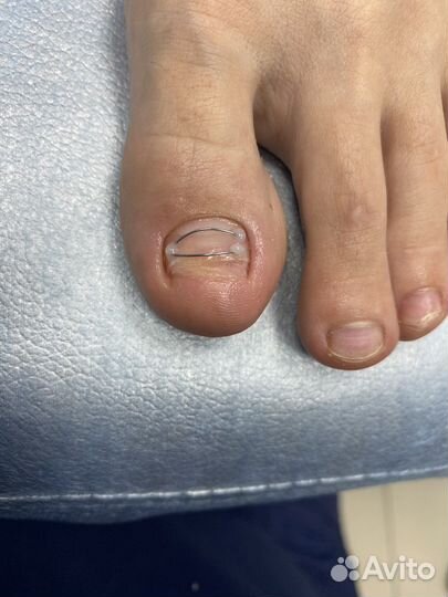 Услуги подолога