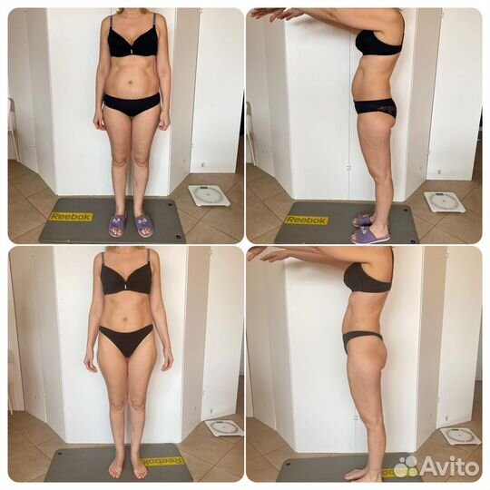 Аппаратный массаж