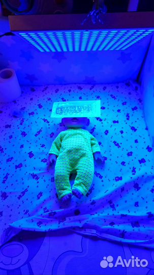 Лампа для лечения желтушки новорождённых (аренда)