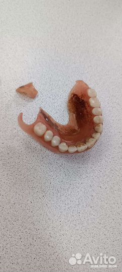 Изготовление и починка съёмных зубных протезов