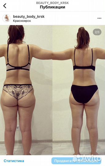 Антицеллюлитный массаж