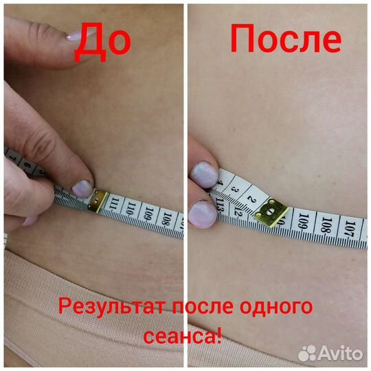 Массаж, тейпирование, rf лифтинг, кавитация