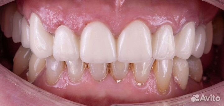 Зубной техник