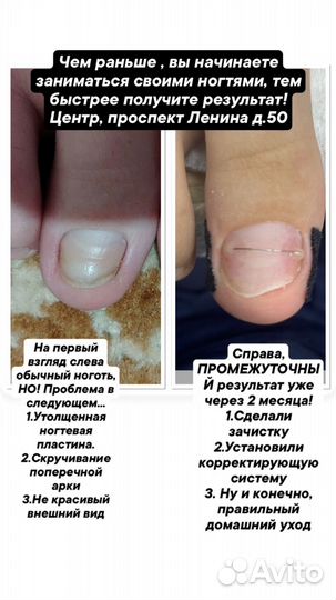 Подолог. Педикюр.Маникюр.Наращивание