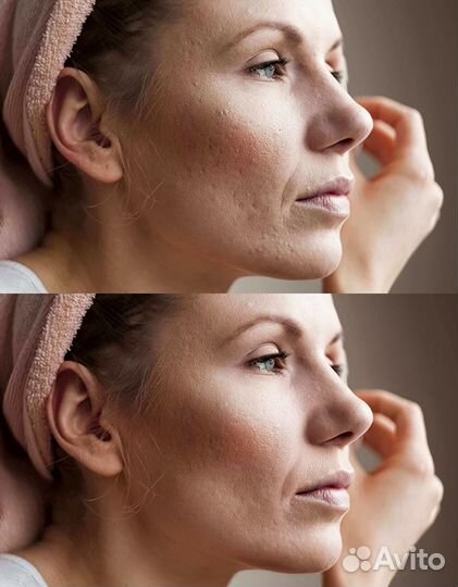 Реставрация и обработка фотографий