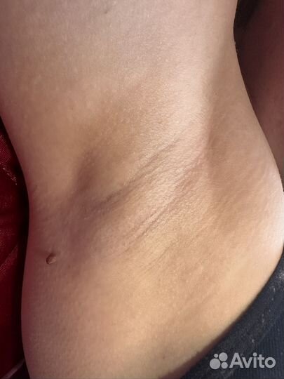 Шугаринг/Ваксинг