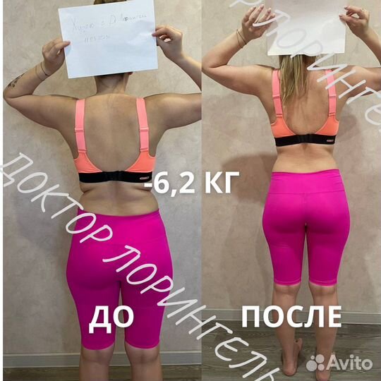 Ламинирование ногтей