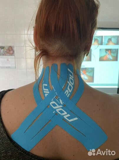 Тейпирование спины, суставов, лица