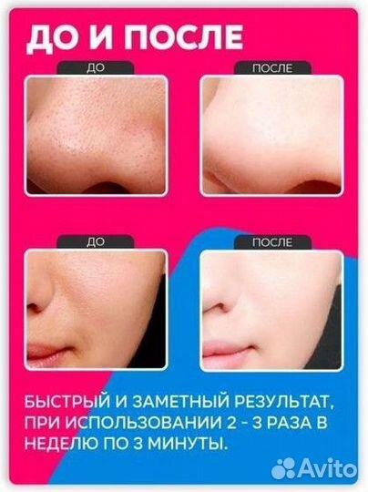 Аппарат для чистки лица (от акне)