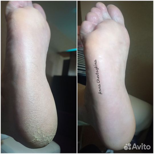 SMART pedicure,педикюр,наращивание, маникюр