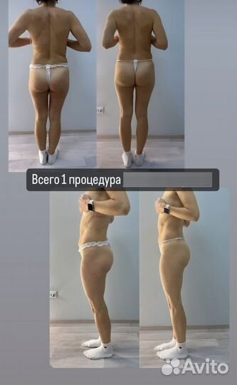 Аппаратный Массаж сферами