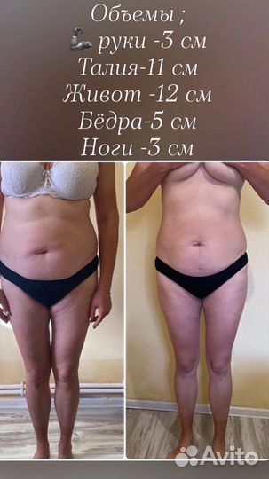 Массажист lpg