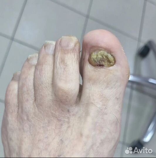 Подолог, мастер педикюра