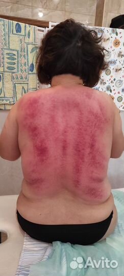 Массаж гуаша