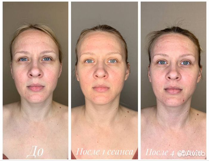 Массаж лица