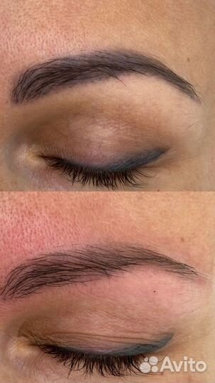 Лазерное удаления тату/татуажа/ /обучение/ модели