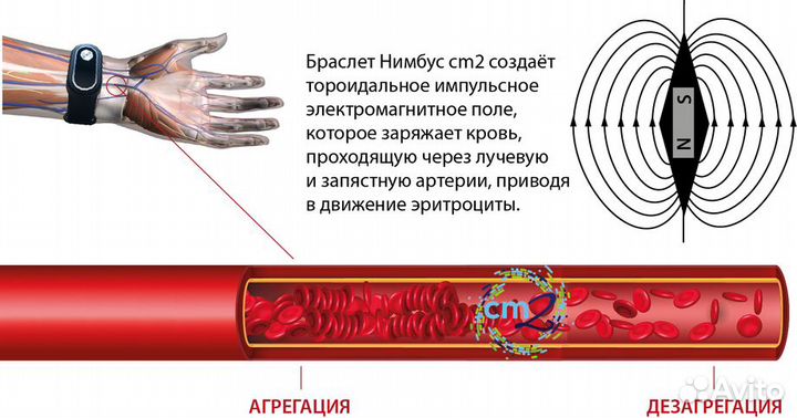 Браслет nimbus cm2 для электро-магнитной терапии