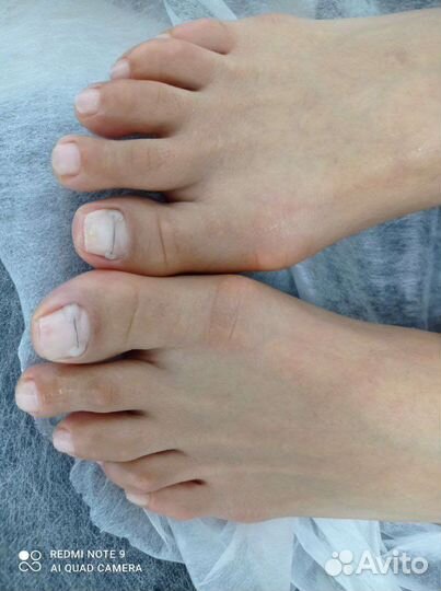 Педикюр любой сложности