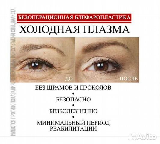 Омоложение без инъекций