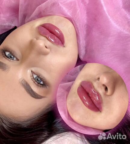 Косметолог,липоредукция, губы,углы,ботокс,ягодицы