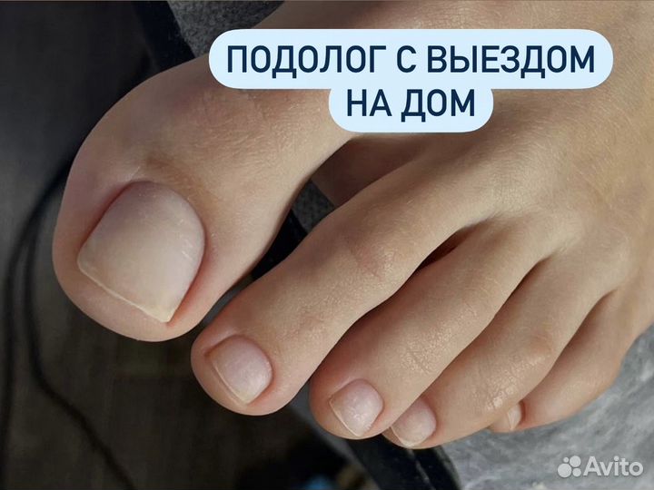 Подолог с выездом на дом