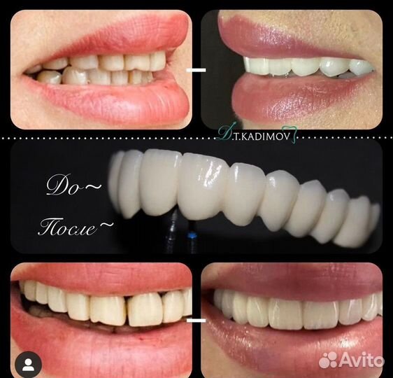 Зубной техник керамист