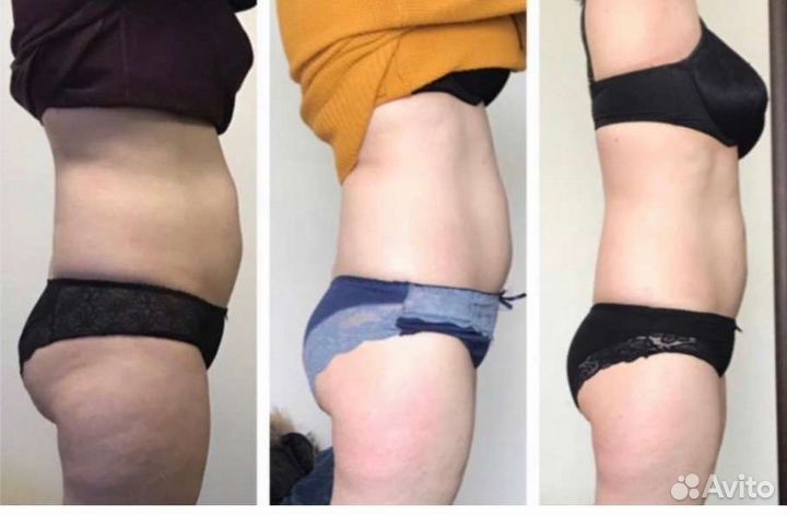 Подтяжка кожи на теле и руках