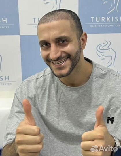 Пересадка волос