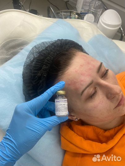 Биopeвитaлизaция