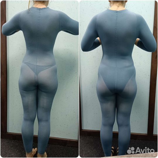 Lpg массаж, коррекция фигуры