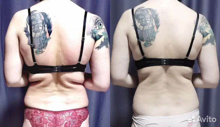 Коррекция фигуры