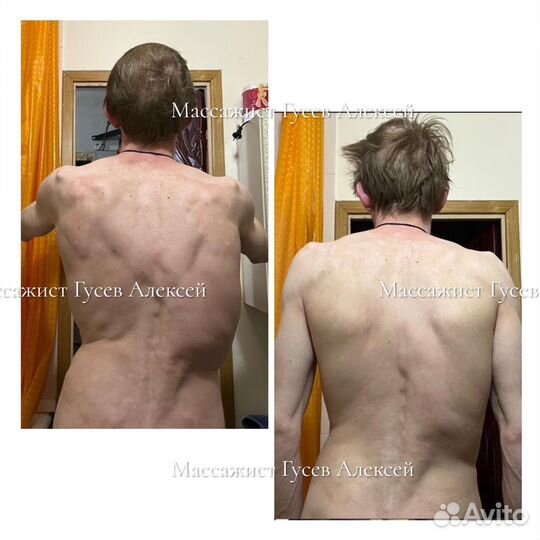 Массаж профессиональный